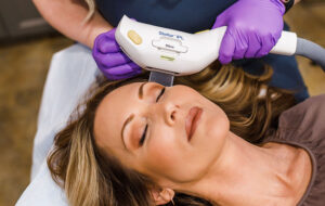 ipl laser treatment