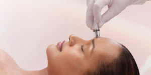 DiamondGlowFacial-VibranceMedicalSpa