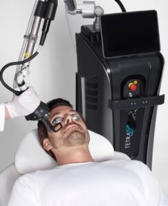 Man-receiving-coolpeel-treatment-on-face | Vibrance Medical Spa