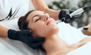 Microneedling-Vibrance-Medical-Spa