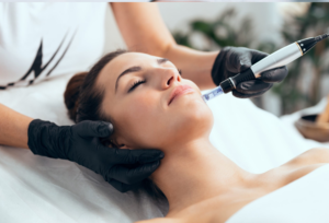 Microneedling-Vibrance-Medical-Spa