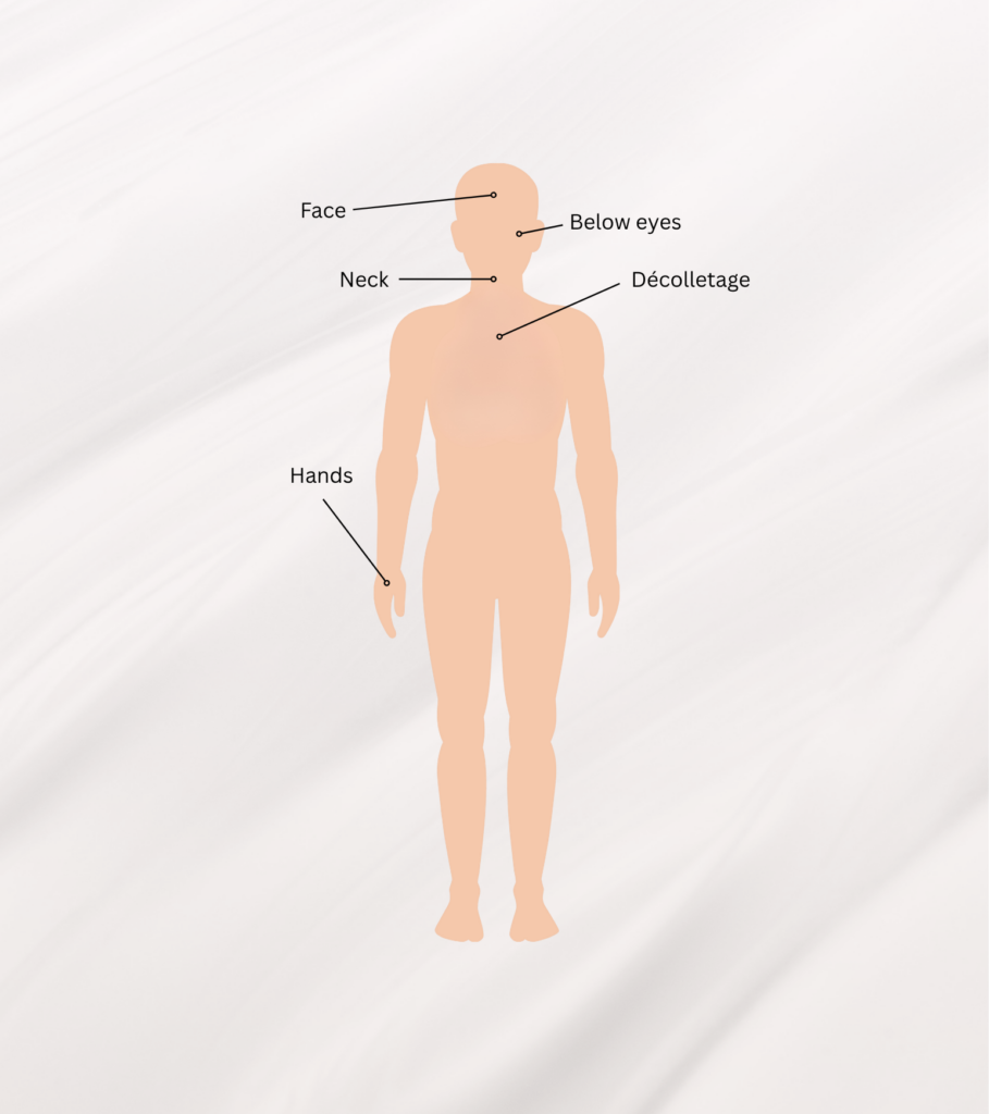 CoolPeel CO2 laser treatment areas face neck chest hands Auburn Lincoln CA