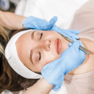 dermaplaning